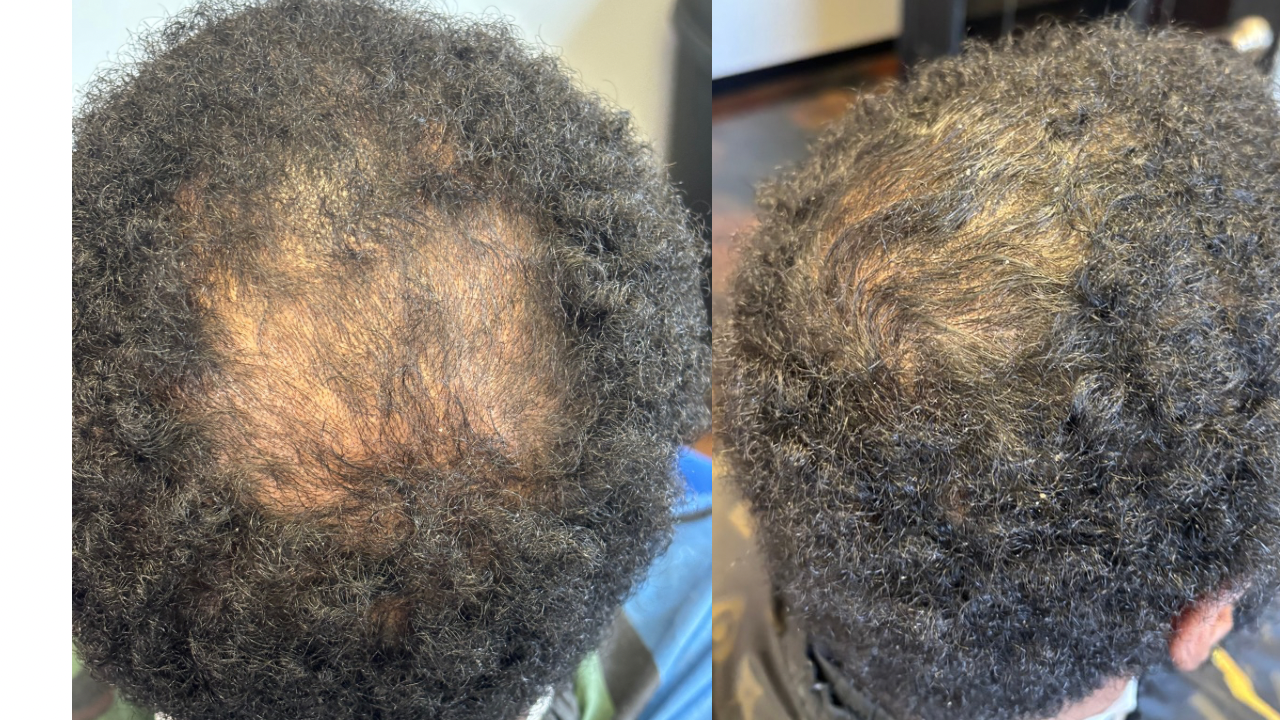 Hair growth oil